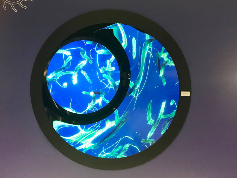 Video Installation von Cholara-Erregern unter dem Mikroskop